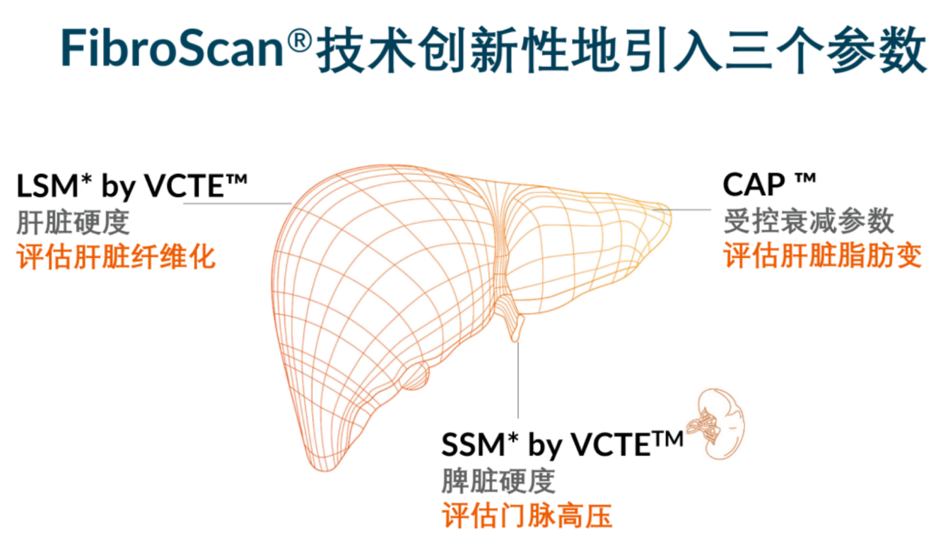 喜訊！FDA擴(kuò)大了FibroScan?在肝臟綜合管理中的應(yīng)用范圍